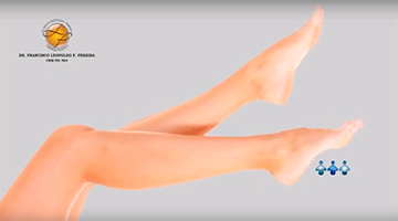 Procedimento cirgurgico