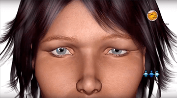 Procedimento cirgurgico